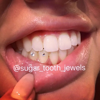 Sugar Tooth Jewels photo 3