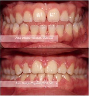 Glendale Orthodontics | Amir Dadgar-Yeganeh DDS, MS