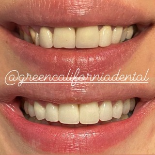 Green California Dental Group: Varand Kerikorian, DDS