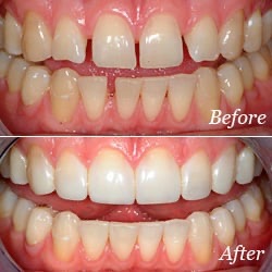 Valley Village Dental