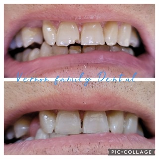 Vernon Family Dental
