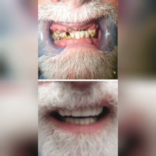 Michael Shirvani, DDS - All Smiles Dental Group