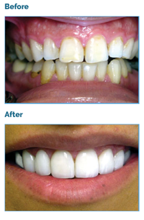 Encino Friendly Dental Center