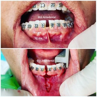 Brite Dental