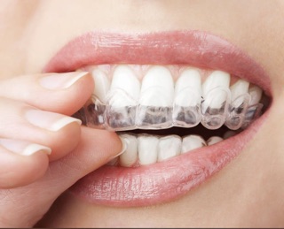 The Whittier Dentist