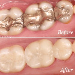 Valley Village Dental