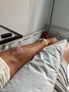 injecting ipamorelin ipamorelin vs ipamorelin cjc 1295 CJC-1295 and Ipamorelin Peptide Injection