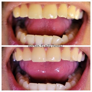 Vernon Family Dental