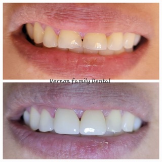 Vernon Family Dental