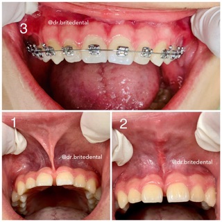 Brite Dental