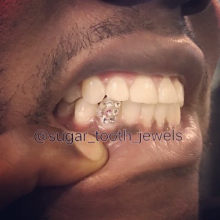 Sugar Tooth Jewels photo 2