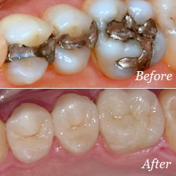 Valley Village Dental