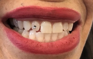 Sugar Tooth Jewels photo 7