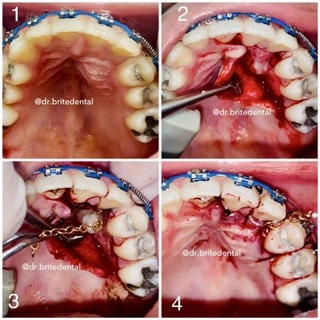 Brite Dental