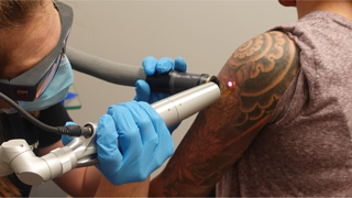 Removery Tattoo Removal & Fading photo 3