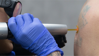 Removery Tattoo Removal & Fading photo 8