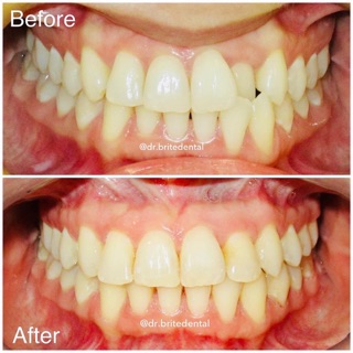 Brite Dental