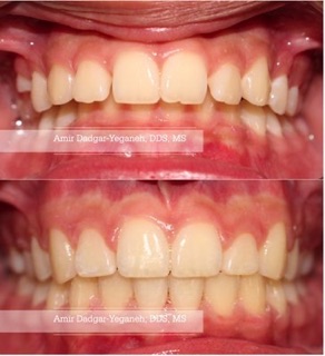 Glendale Orthodontics | Amir Dadgar-Yeganeh DDS, MS
