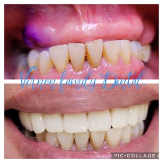 Vernon Family Dental